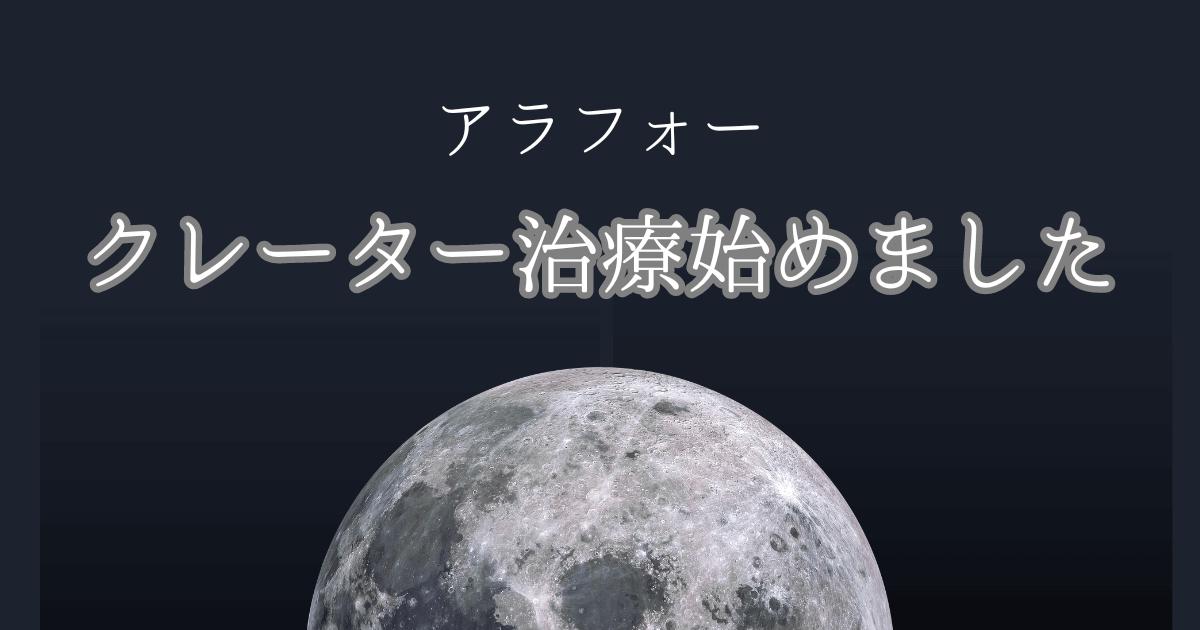 アラフォー　クレーター治療始めました